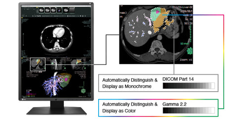 Display Both Monochrome and Color - EIZO RadiForce RX660 6MP LCD LED Color Display available at ERI