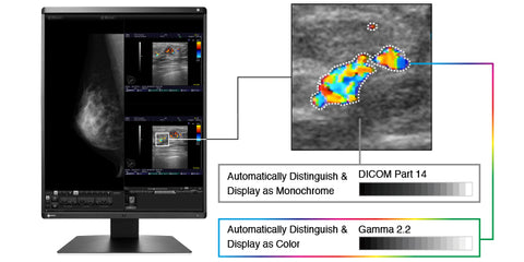 Display Both Monochrome and Color - EIZO RX560 5MP LCD Color Display available at ERI