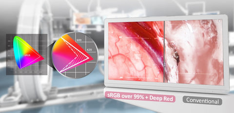 IPS & 115％ OF sRGB Enhancing Deep Red - LG 27HJ713S-W 27" 4K LED Surgical Display available at ERI