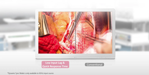 DYNAMIC SYNC MODE - LG 27HJ713S-W 27" 4K LED Surgical Display available at ERI