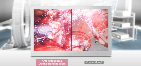 Anti-reflection & Optical Bonding Glass - LG 27HJ713S-W 27" 4K LED Surgical Display available at ERI
