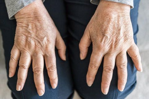 Zimt Vorteile Entzündung Arthritis