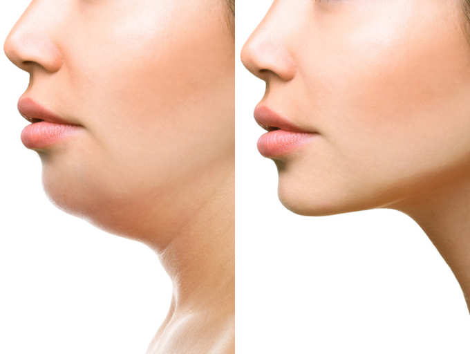 Get Rid Of Your Your Double Chin Love Skin And Hair Facial