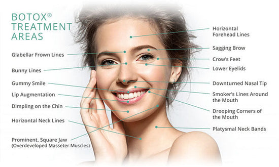 Botox treatment areas