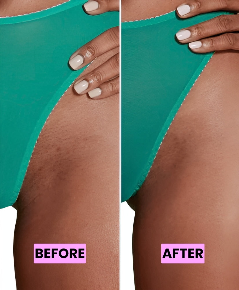 'Comparison of skin texture on the inner thigh before and after using a product.'