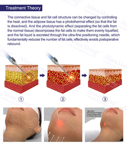 Surgery Plastic Body Slimming 980nm 1470nm Diode Laser