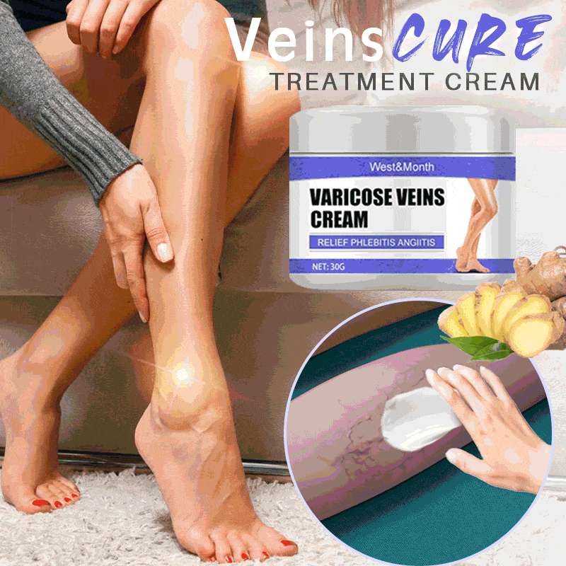 Veins Cure Varicose Treatment Cream – candleriddle