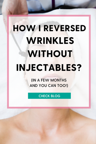 reduce wrinkles without botox