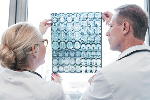 MND-Motor-Neurone-Disease-doctors-looking-at-brain-scan
