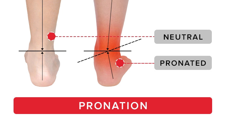 pronation insoles