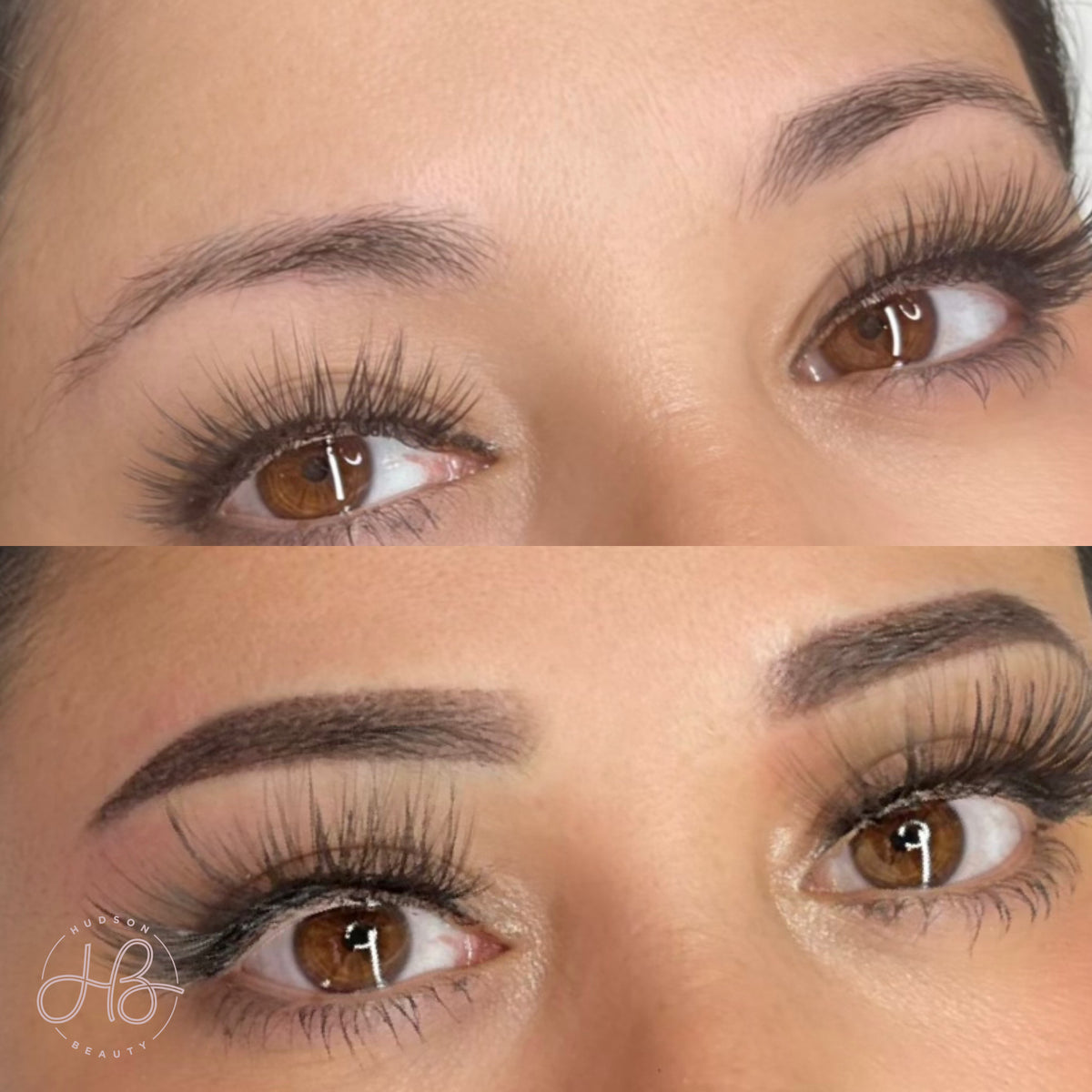 Permanent Makeup Removal New Jersey - Reflections Center