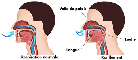 Le ronflement et les causes