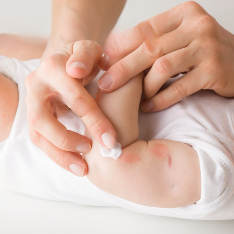 Common Skin Conditions in Babies