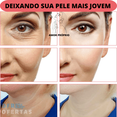 Aparelho Facial Tonifica e Rejuvenesce SkinBeauty Tratamento Facial 5 em 1