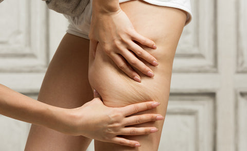 The Best Strategy To Use For What Is Cellulite And What Causes It? - Nature's Blends thumbnail