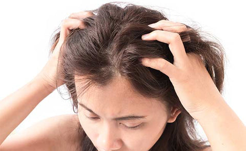 dandruff scalp fungus