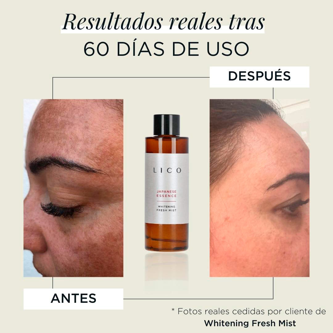 acido tranexamico melasma