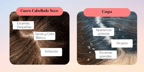 diferencia entre la caspa y el cuero cabelludo seco