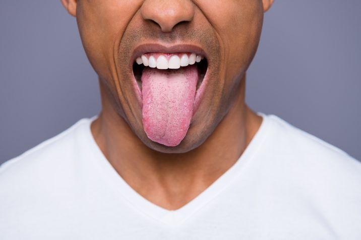 Vaper's Tongue: What is, how get it and Cures It