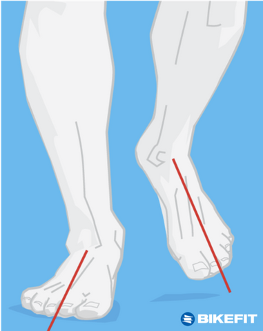 Illustration showing angles of foot rotation
