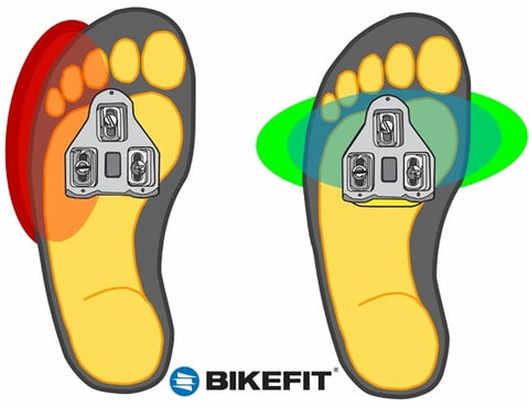 Digital heat map illustration that shoes pressure on foot with and without a cleat wedge