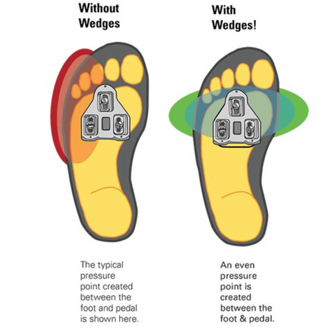 Illustration of pressure on the foot with and without cleat wedges