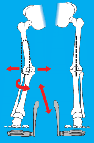 Anatomical illustration of a leg that is not properly aligned