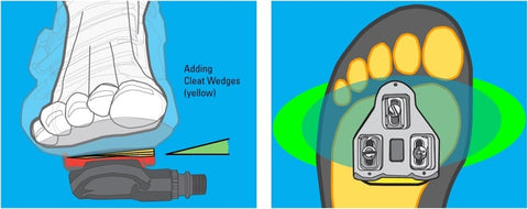 Illustration showing balanced pressure on foot and cleat when cleat wedge is used