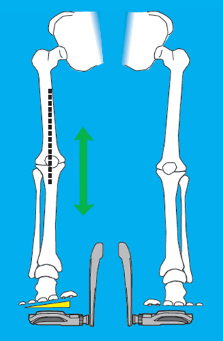 Anatomical illustration of a leg that is properly aligned