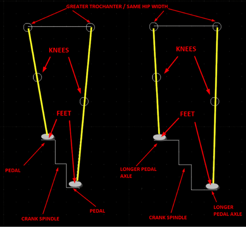 Diagram that shows impact to knee alignment