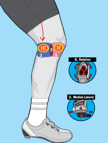 Illustration highlighting where knee paid can occur