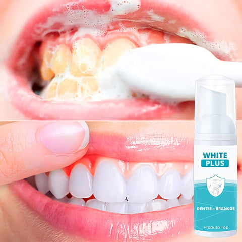 clareador dental instantaneo white plus - loja produto top