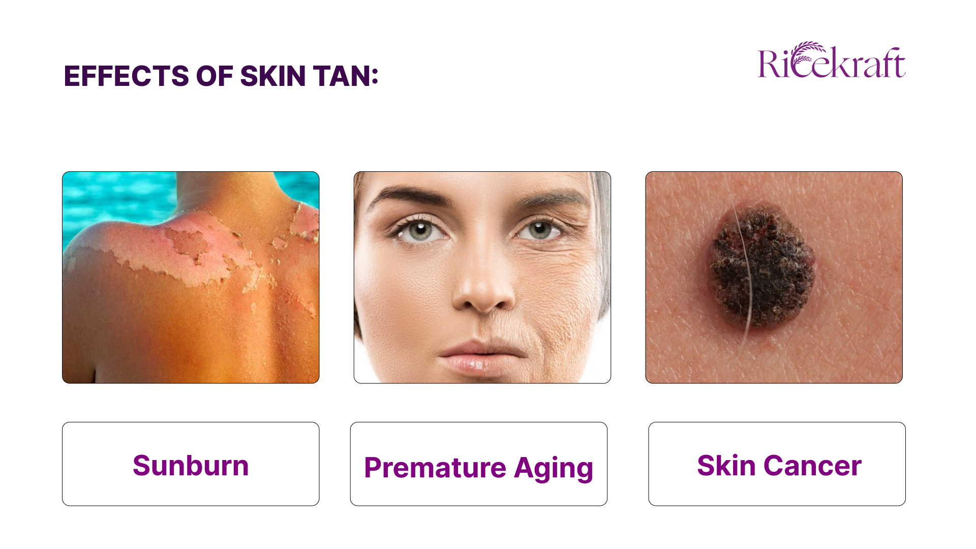 Effects of sun tan such as sunburn, skin cancer and premature aging