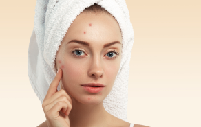 acne_management