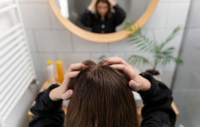 prevents_dandruff