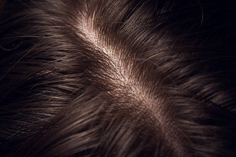 Close-up of a healthy, dandruff-free scalp.