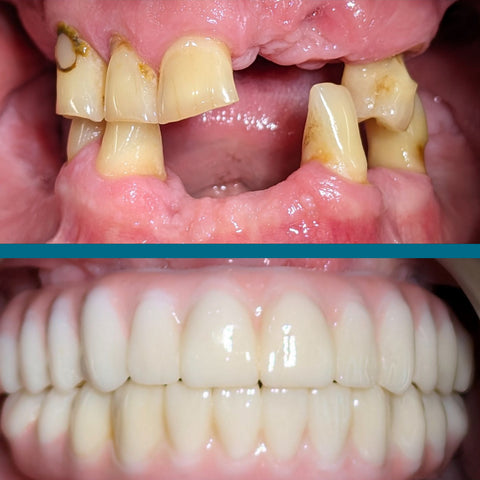 patients closeup before and after smile