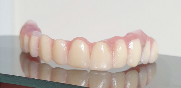 Zirconia hybrid prosthesis custom made for the patients mouth