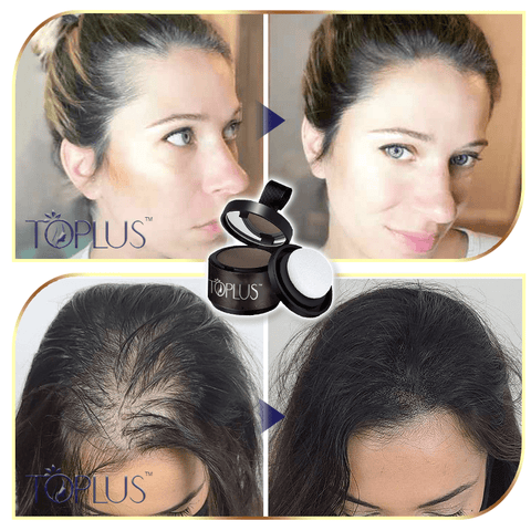 Toplus™ Premium Hairline Coverage Touch Up Powder
