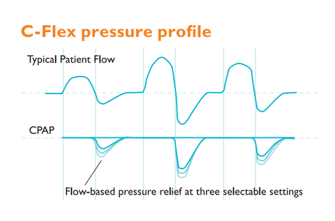 Diagram showing the C-Flex pressure profile as part of Respironics Flex technologies that feature on their CPAP machines