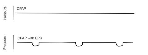 Diagram showing how the Expiratory Pressure Relief comfort setting on ResMed CPAP machines work to make CPAP therapy more comfortable