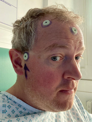 Miles Jupp after his operation