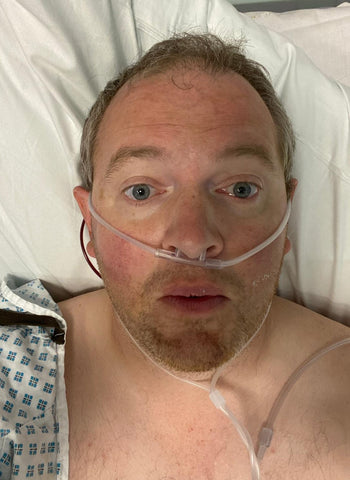 Miles Jupp before his surgery