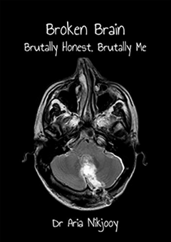 Broken Brain: Brutally Honest, Brutally Me - Dr Aria Nikjooy