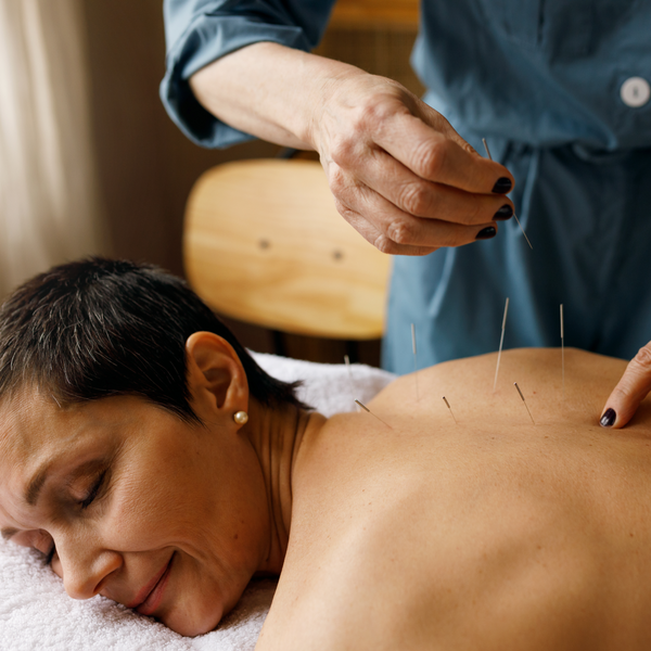 Vertical shot of skilled red haired female practitioner using Chinese medicine technique for balancing flow of energy through meridians in patient body, inserting acupuncture needles into skin