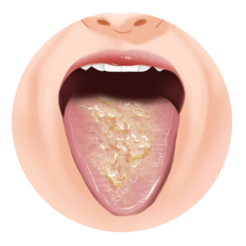 tongue coating