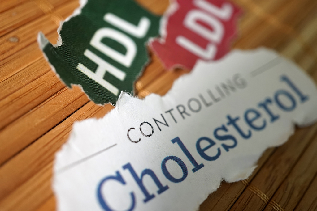 Cholesterol levels