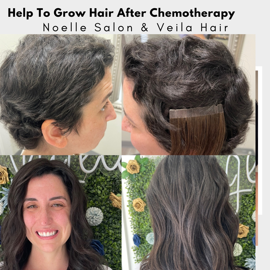 Help To Grow Hair After Chemotherapy – noellesalon