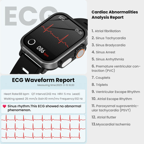 ECG SMART WATCH