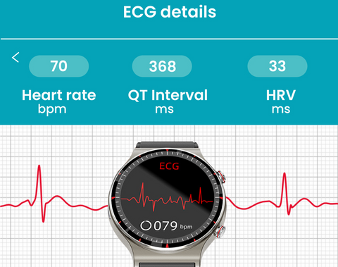 ecg smart watch